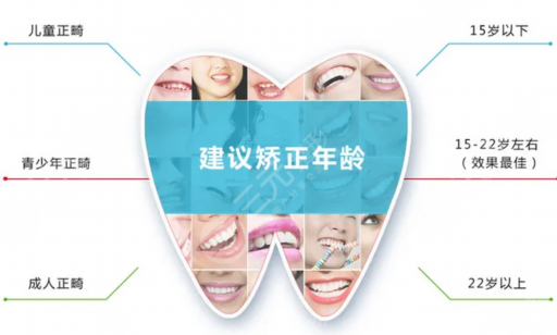 贴面对比皓齿美白的优点（皓齿美白危害）(图1)